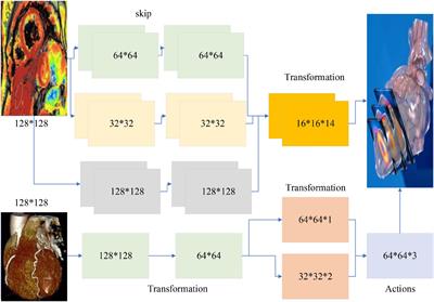 Artificial Intelligence Segmented Dynamic Video Images for Continuity Analysis in the Detection of Severe Cardiovascular Disease